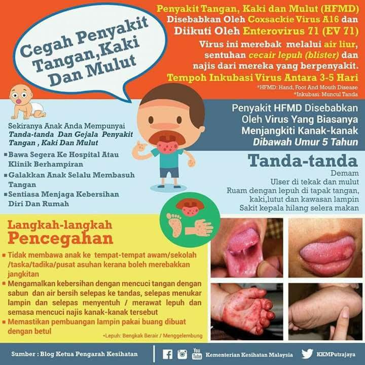 Penyakit tangan kuku dan mulut